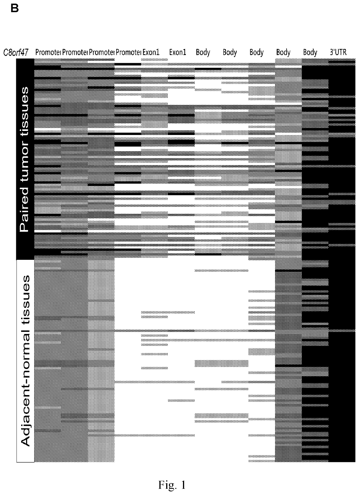 Methods for early prediction, treatment response, recurrence and prognosis monitoring of breast cancer