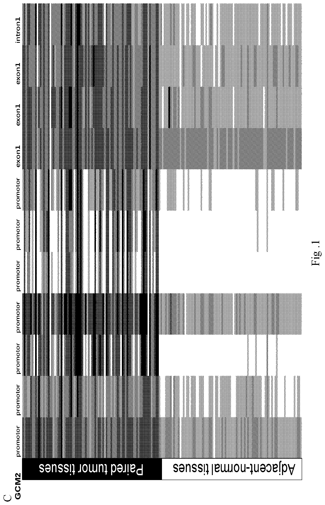 Methods for early prediction, treatment response, recurrence and prognosis monitoring of breast cancer