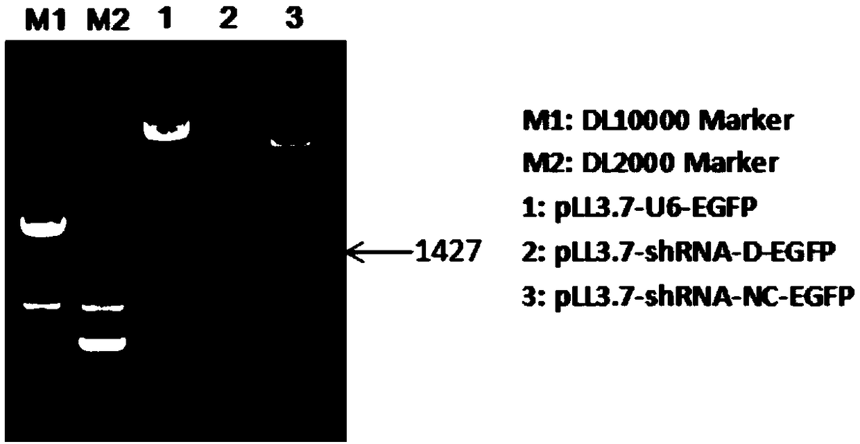 Gene HDAC11 interfered chimeric antigen receptor T-cell and application thereof