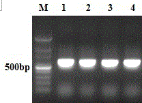 Prostate-cancer-specific PAP (prostatic acid phosphatase)-GM-CSF (granulocyte-macrophage colony-stimulating factor)-IL-6 (interluekin-6) genetic recombinant fusion protein and preparation method thereof