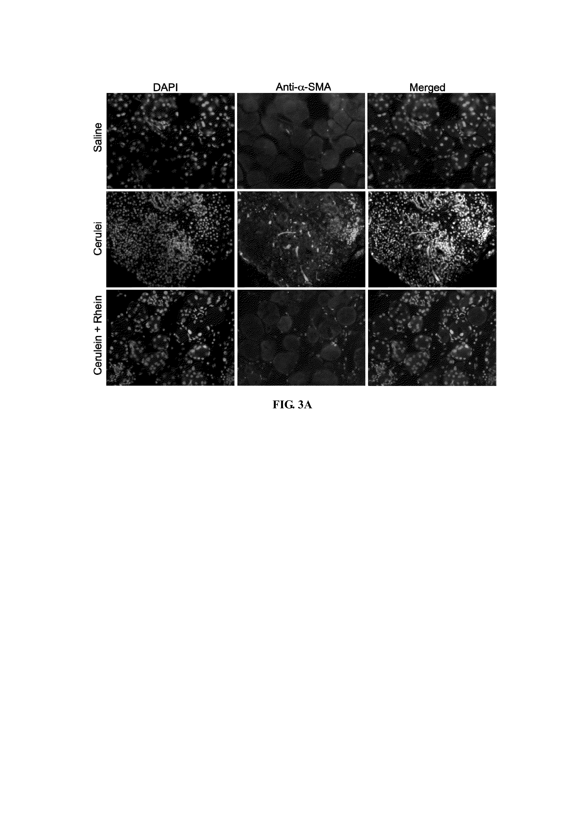 Method Of Using Rhein For Treating Fibrotic Conditions And Tumors