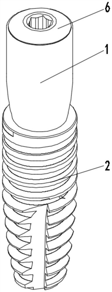 Method and device for constructing healing abutment for tooth implantation and restoration