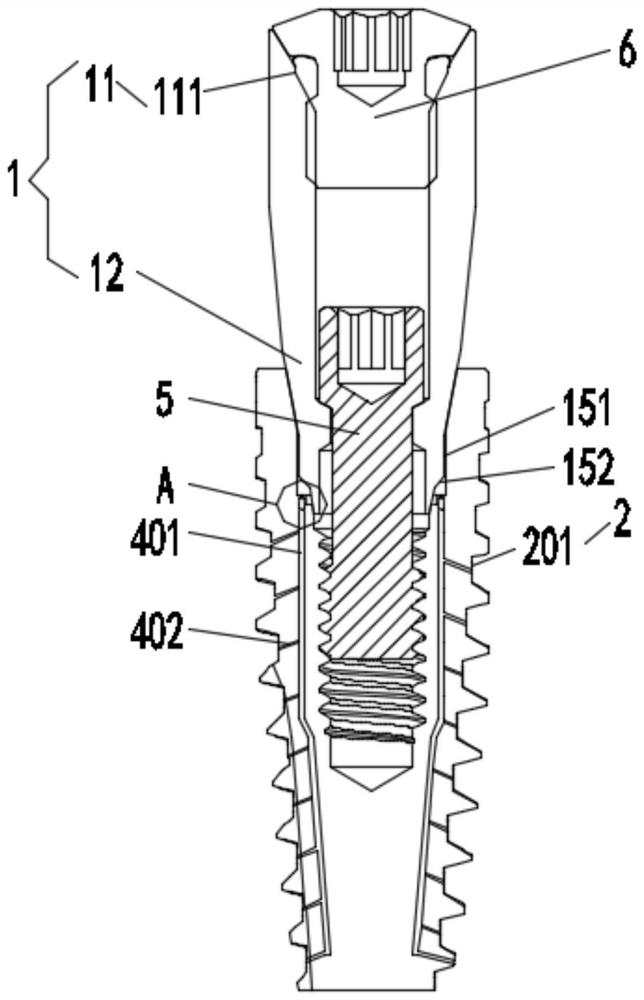 Method and device for constructing healing abutment for tooth implantation and restoration