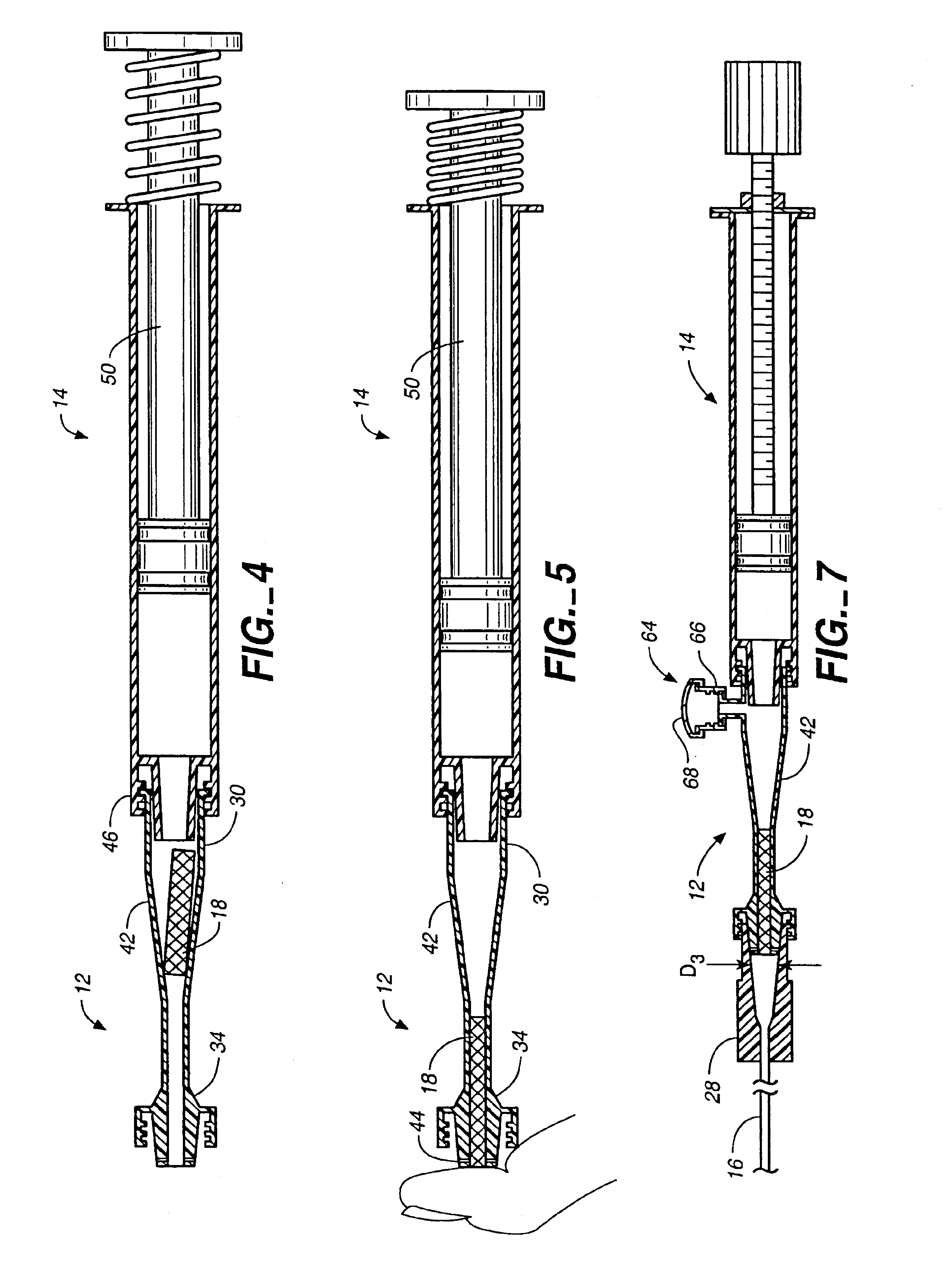 Device and method for facilitating hemostasis of a biopsy tract