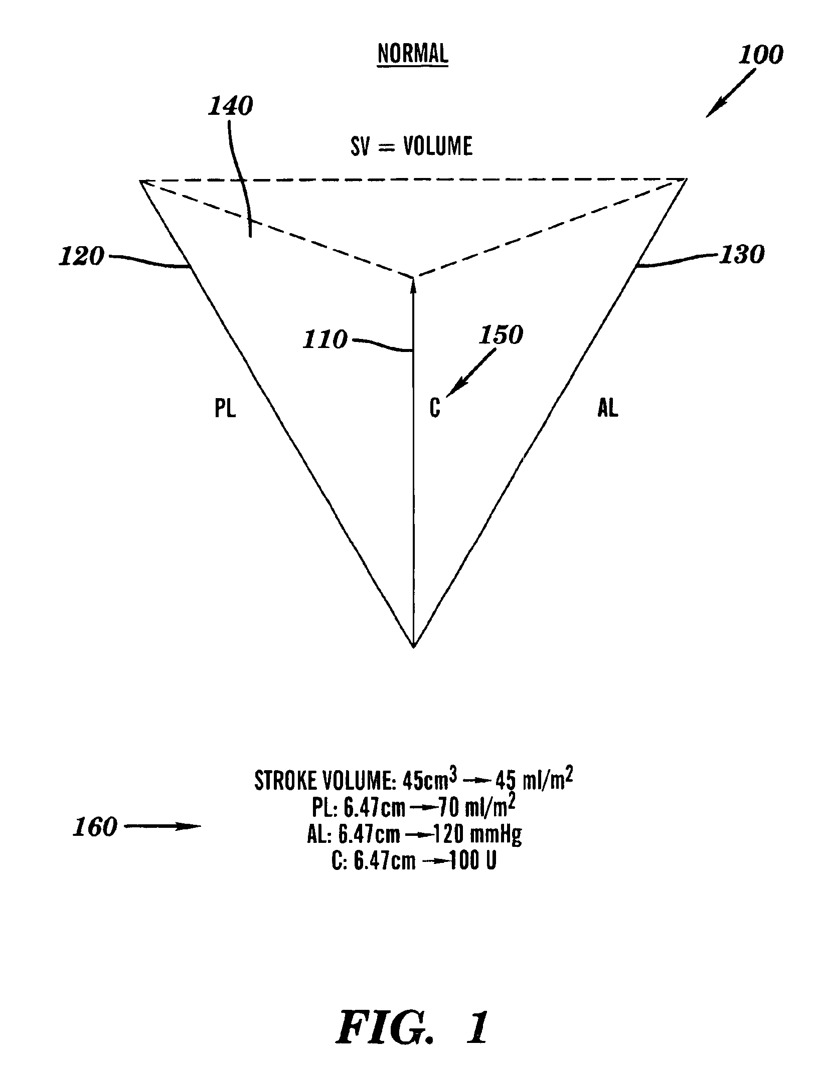Method and system of determining cardiac contractility