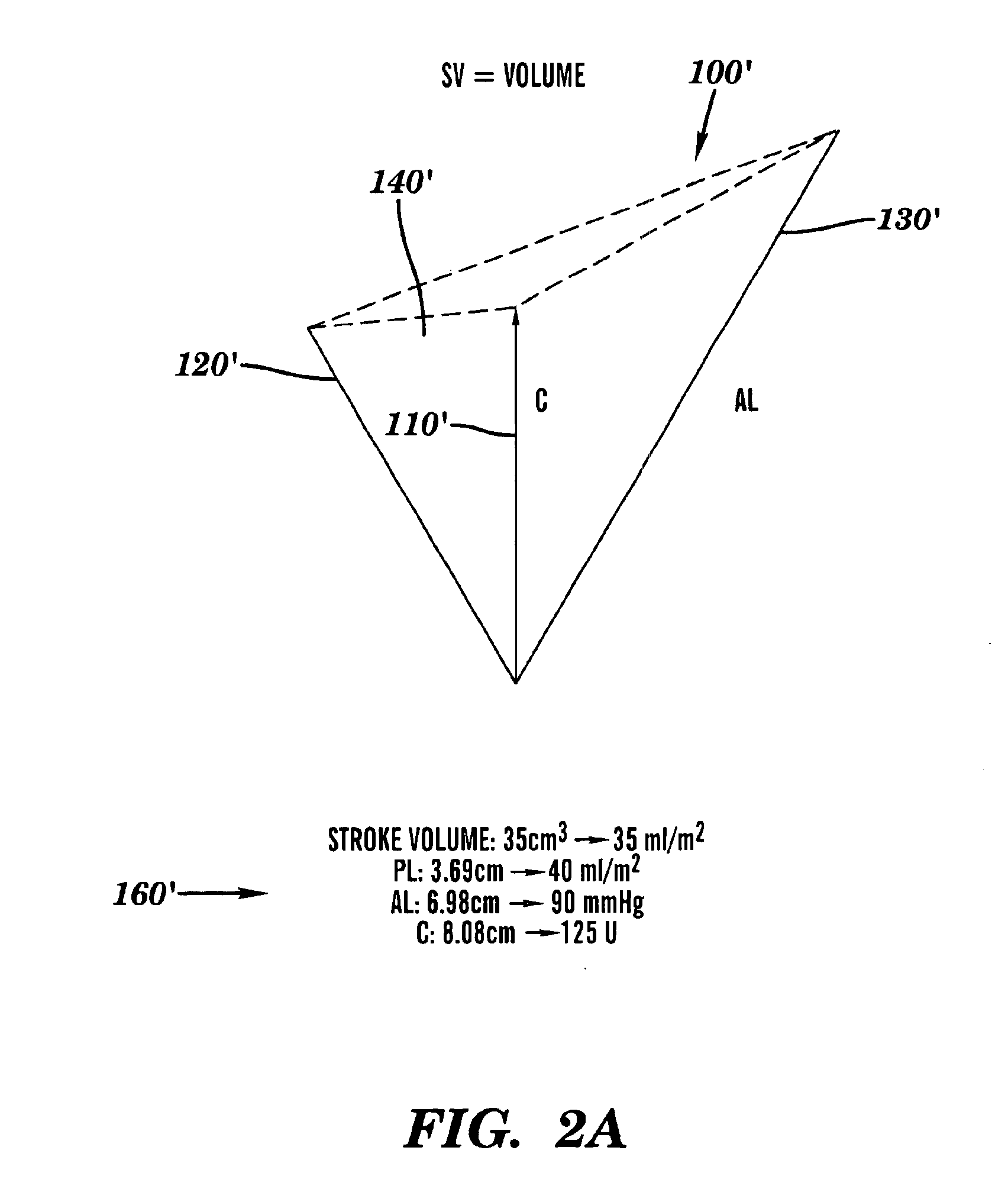 Method and system of determining cardiac contractility