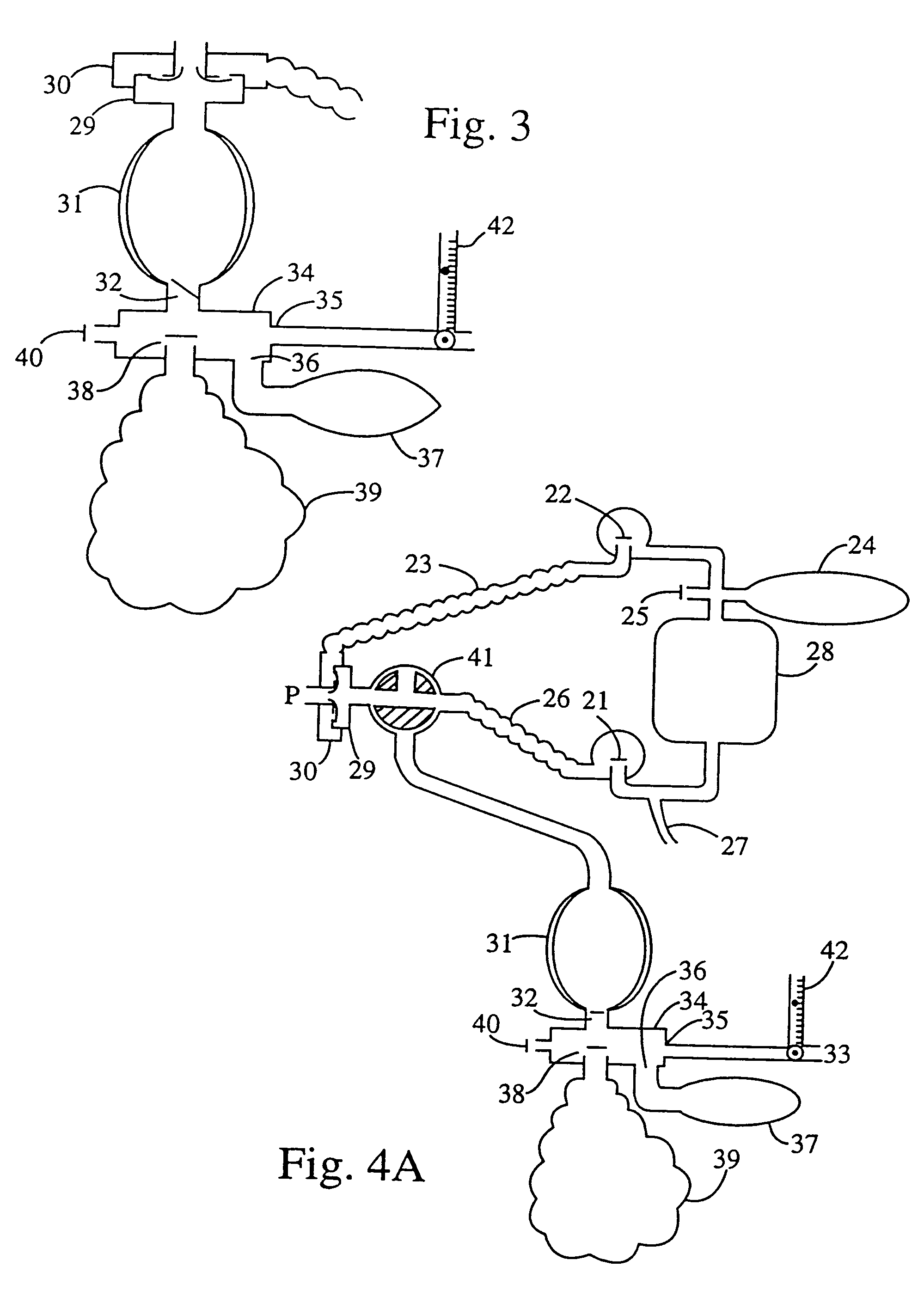 Method of maintaining constant arterial PCO2 and measurement of anatomic and alveolar dead space