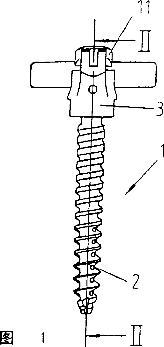 Pedicle screw