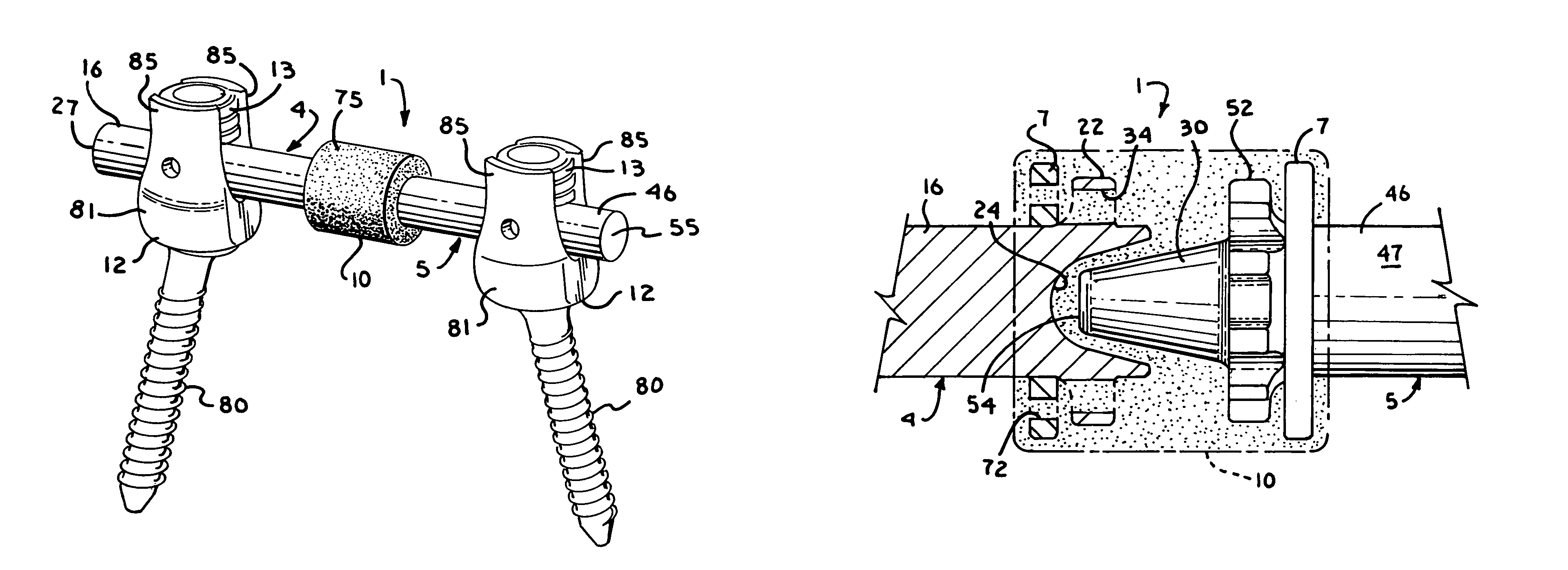 Dynamic stabilization assembly with frusto-conical connection