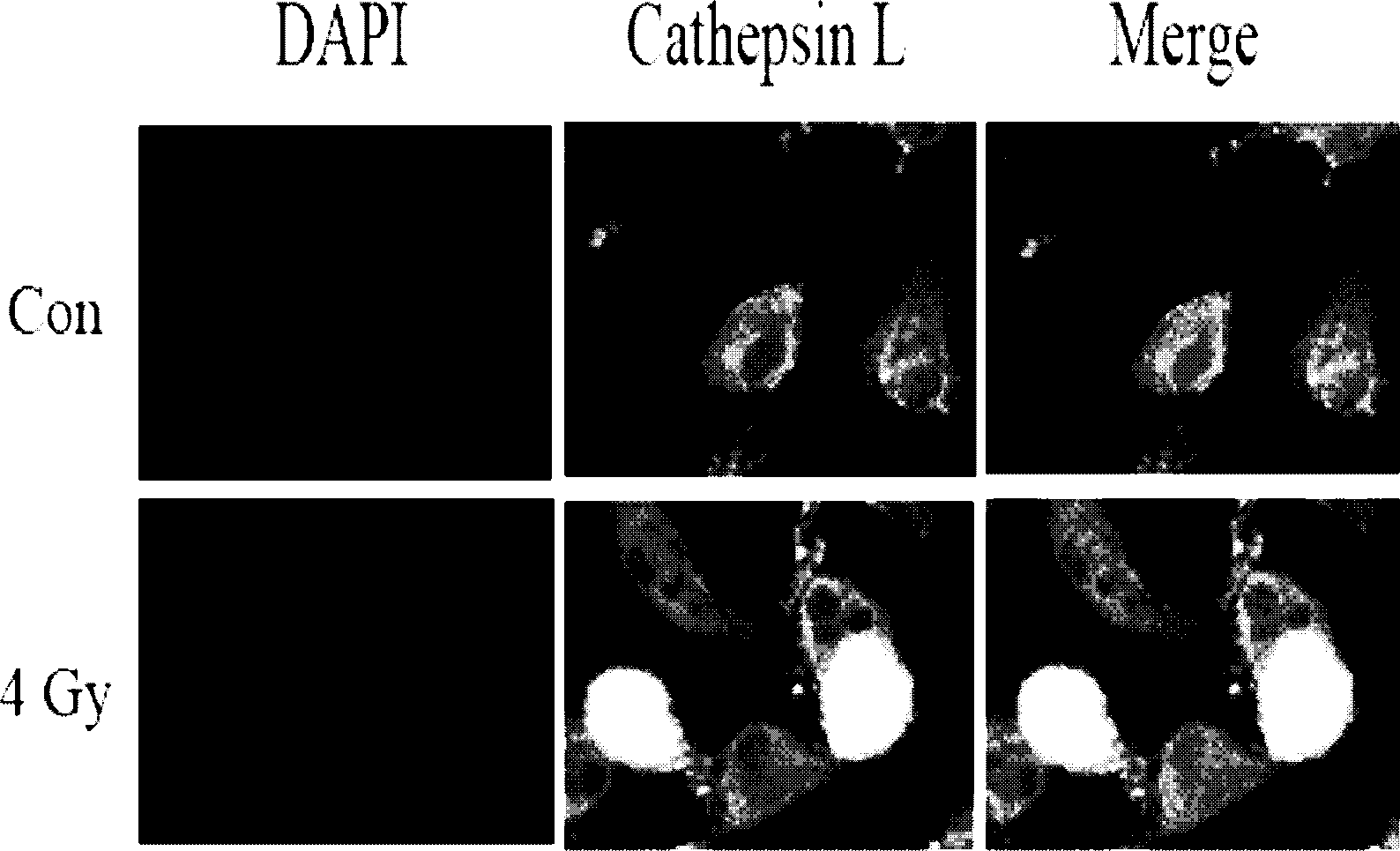 Use of cathepsin L inhibitor in preparation of radiotherapeutic sensitization drug