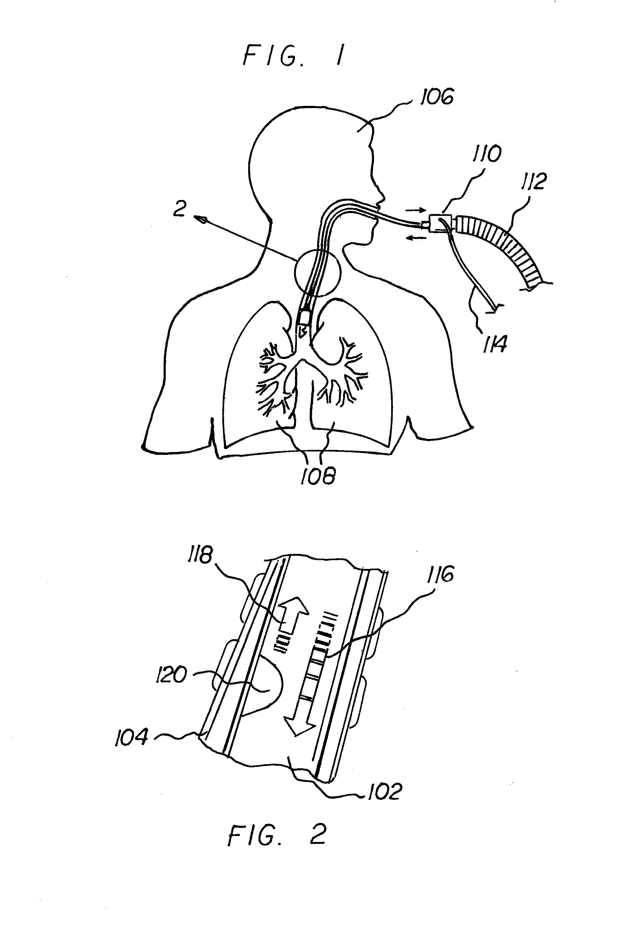 System and Method for Use of Acoustic Reflectometry Information in Ventilation Devices