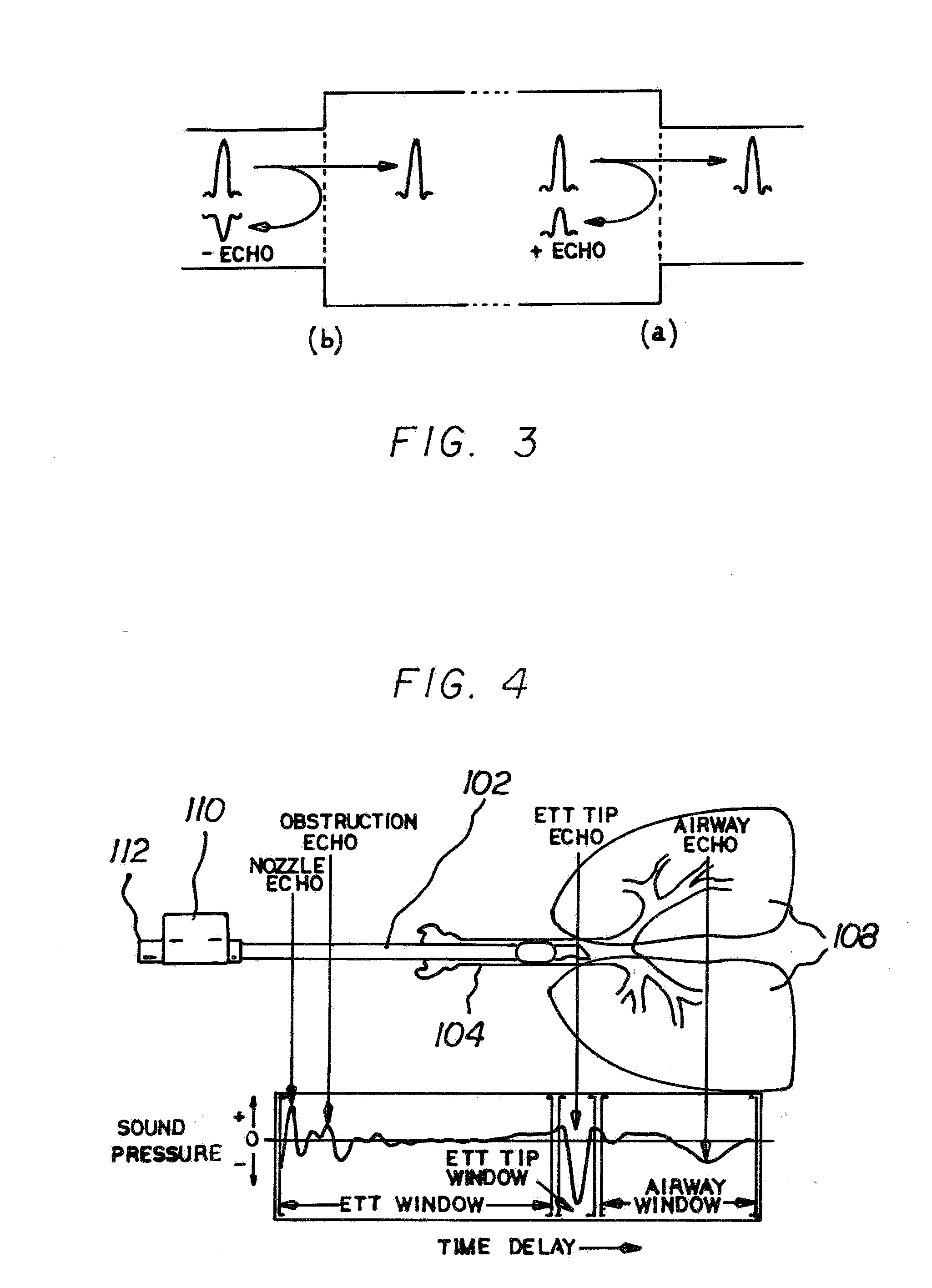System and Method for Use of Acoustic Reflectometry Information in Ventilation Devices