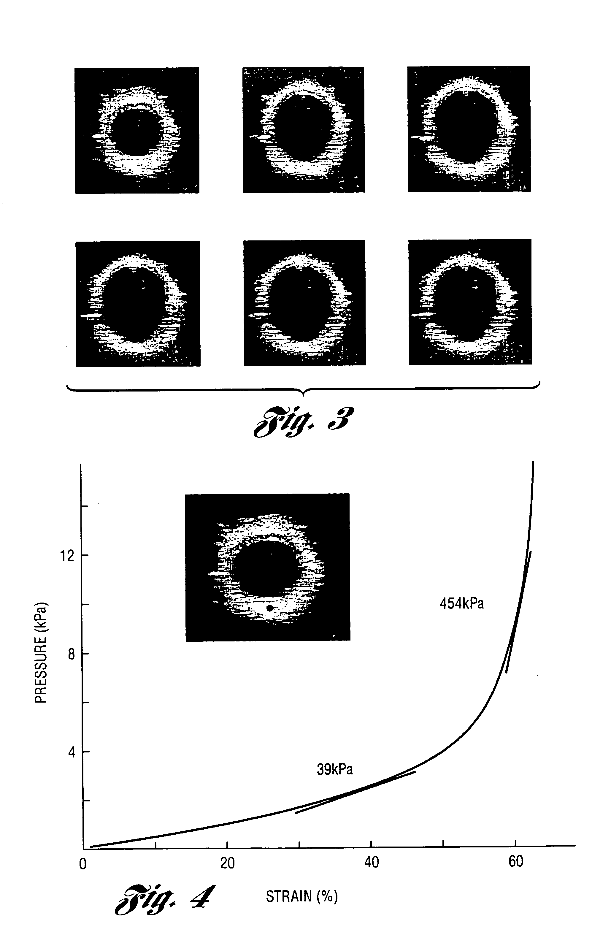 Methods and systems for measuring mechanical property of a vascular wall and method and system for determining health of a vascular structure