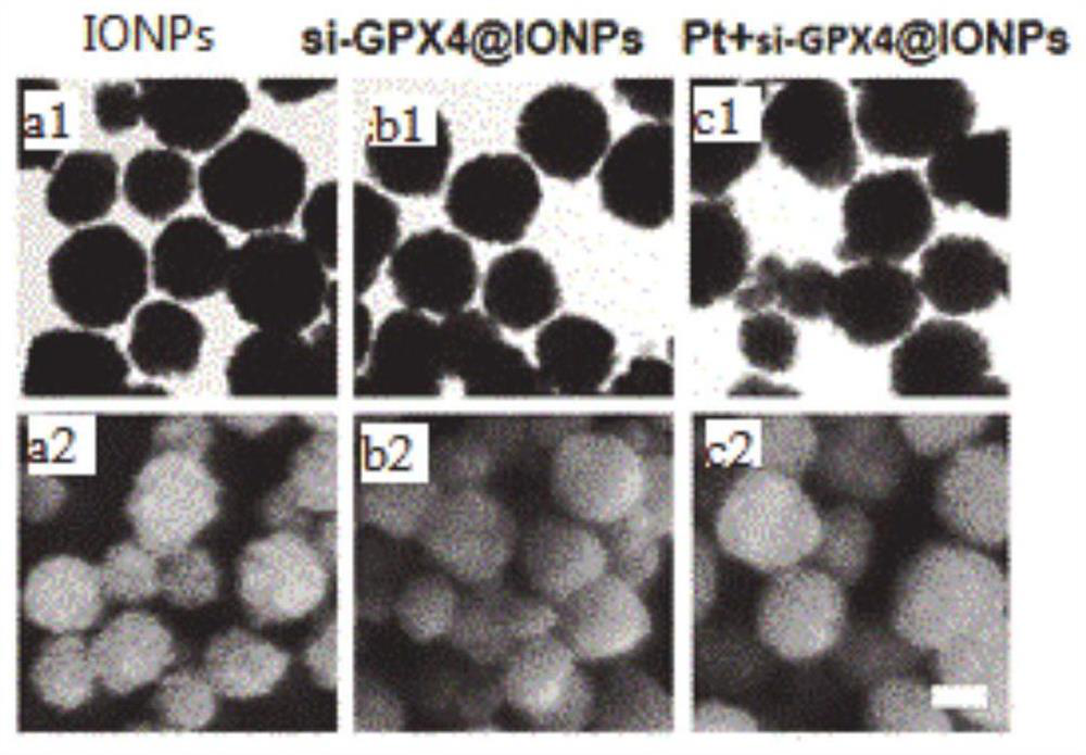 A kind of nanoparticle and its preparation method and application