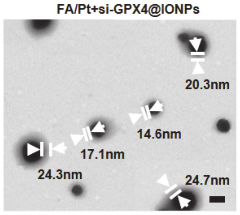 A kind of nanoparticle and its preparation method and application