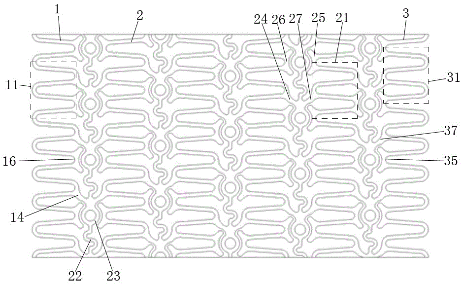 A low resilience high support coronary artery degradable stent