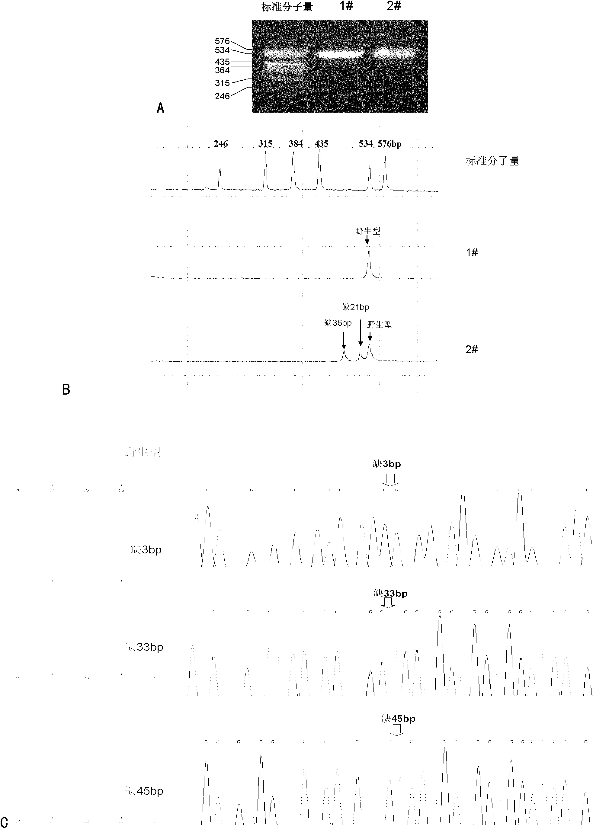 Method and reagent for detecting HBV (hepatitis B virus) pre-S gene variation