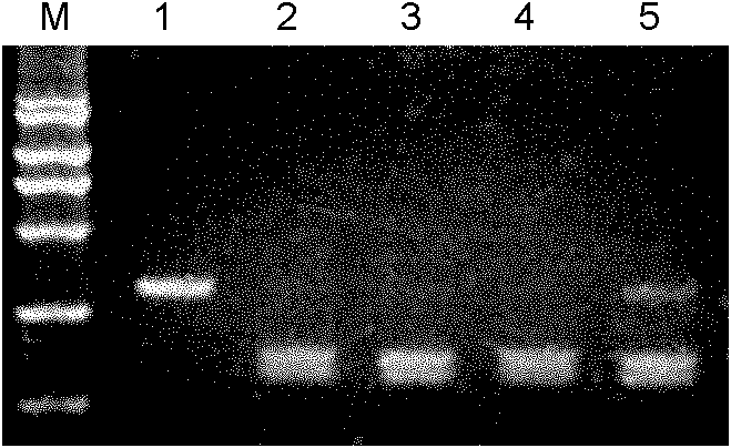 Method and reagent for detecting HBV (hepatitis B virus) pre-S gene variation