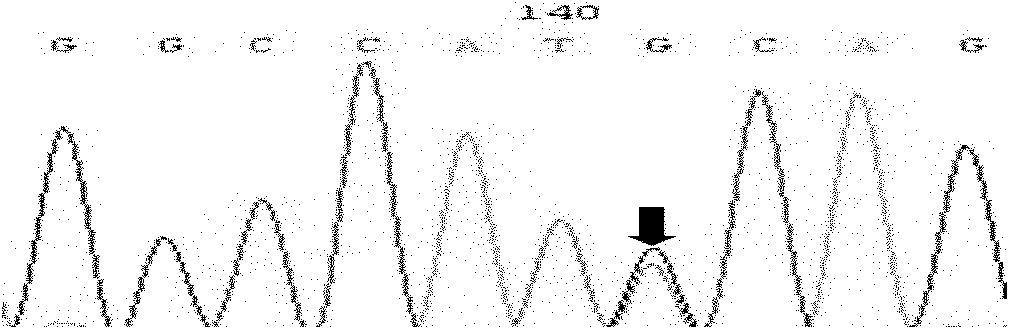 Method and reagent for detecting HBV (hepatitis B virus) pre-S gene variation