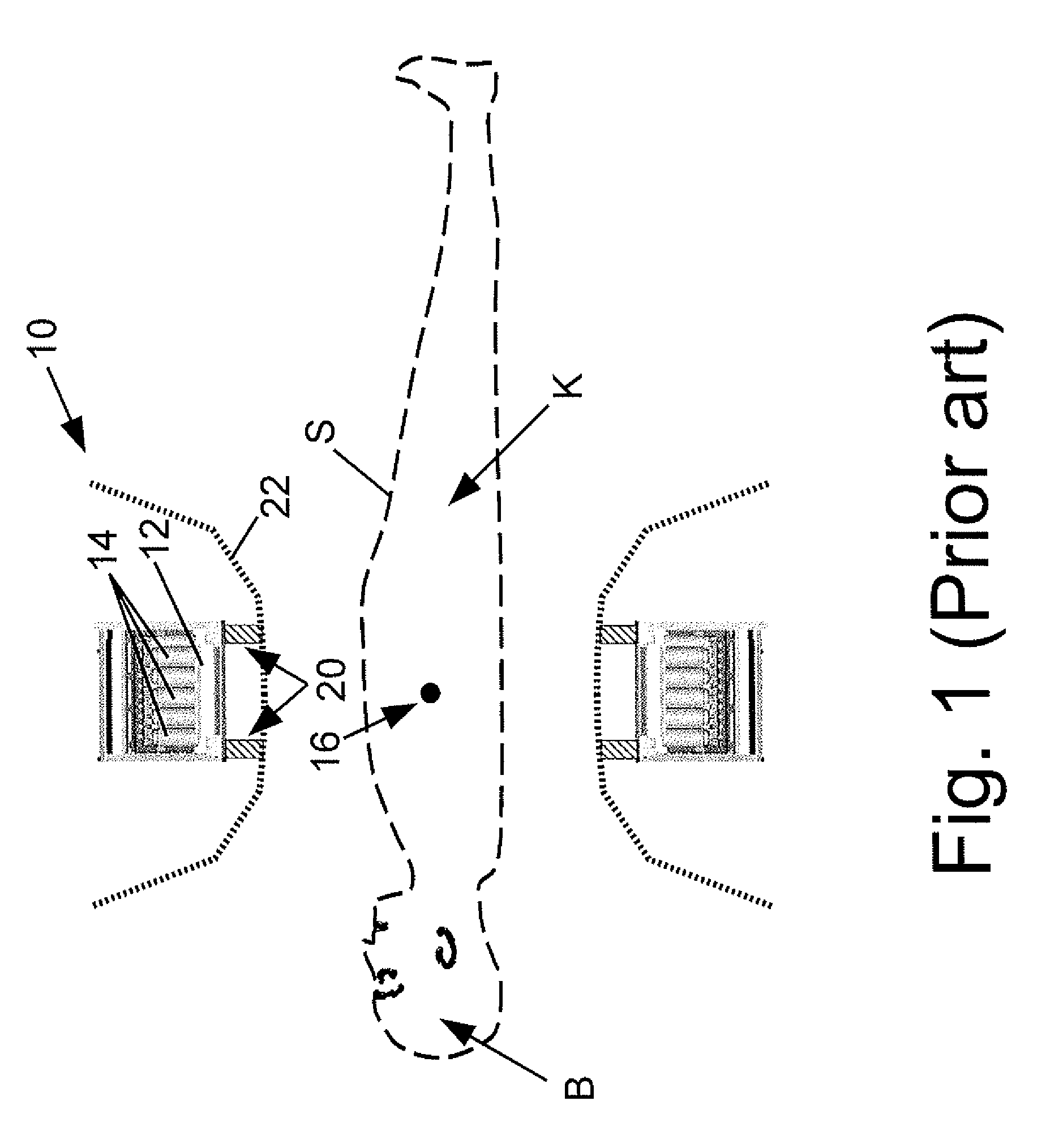 Large bore PET and hybrid PET/CT scanners and radiation therapy planning using same