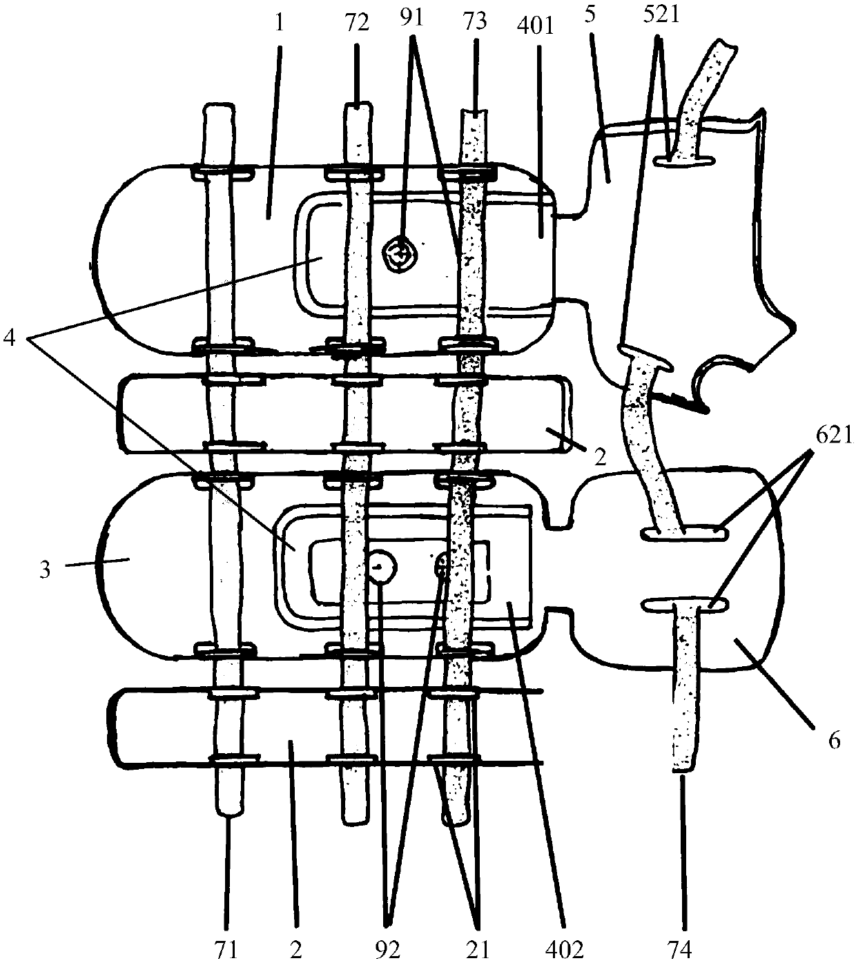 Non-invasive traction-type splint