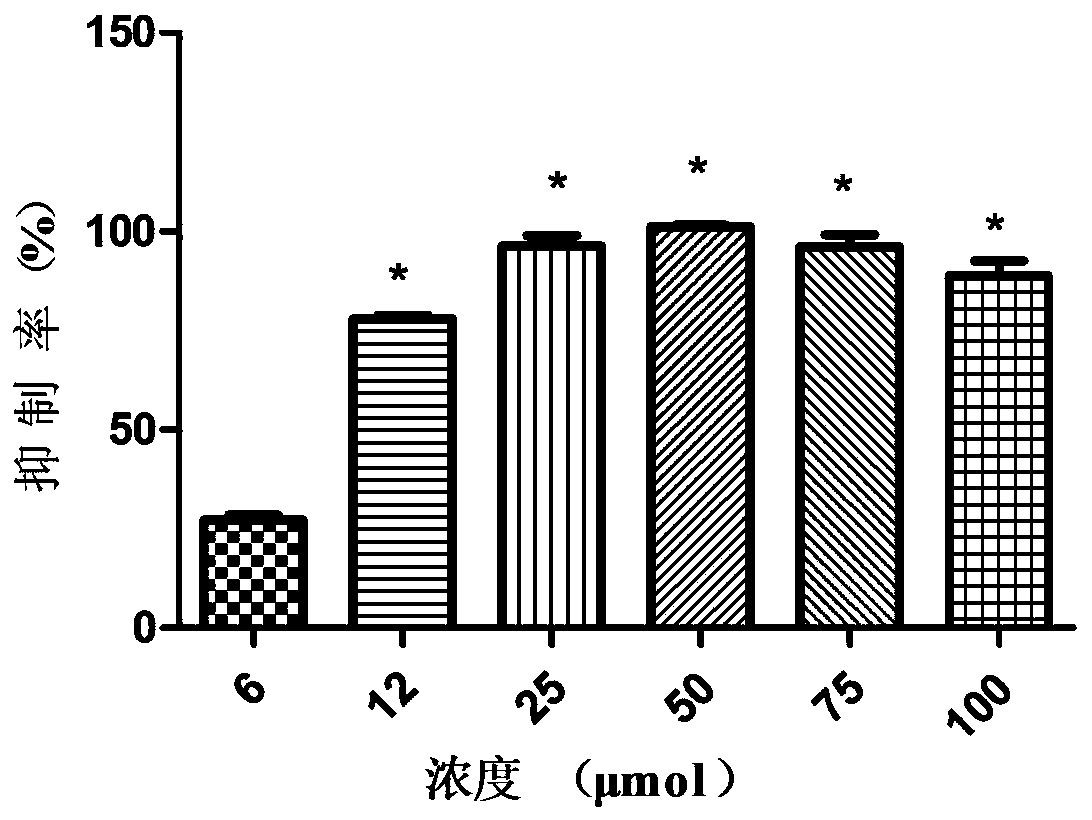 Application of mycophenolate mofetil in preparing medicine for preventing or treating foot-and-mouth disease virus infection