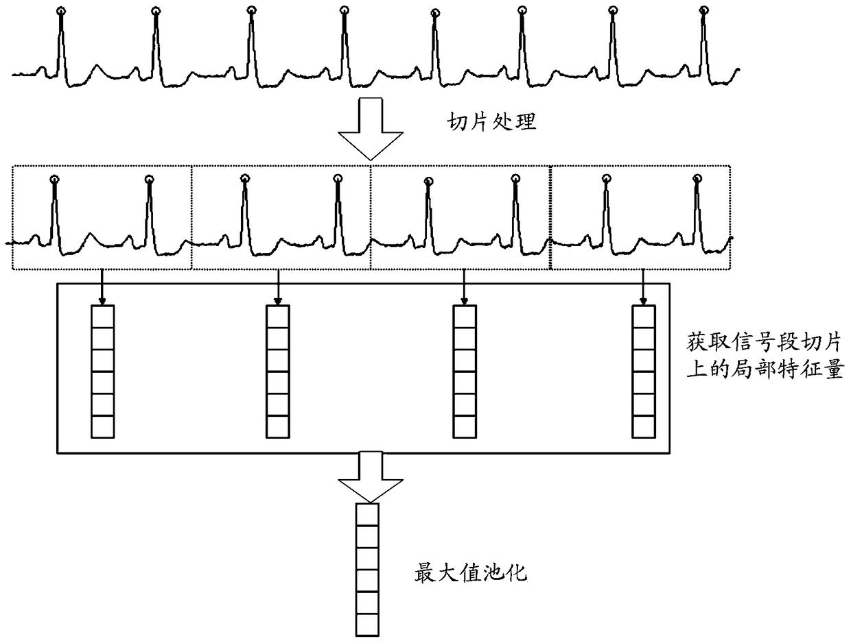 ECG lead intelligent selection method and system