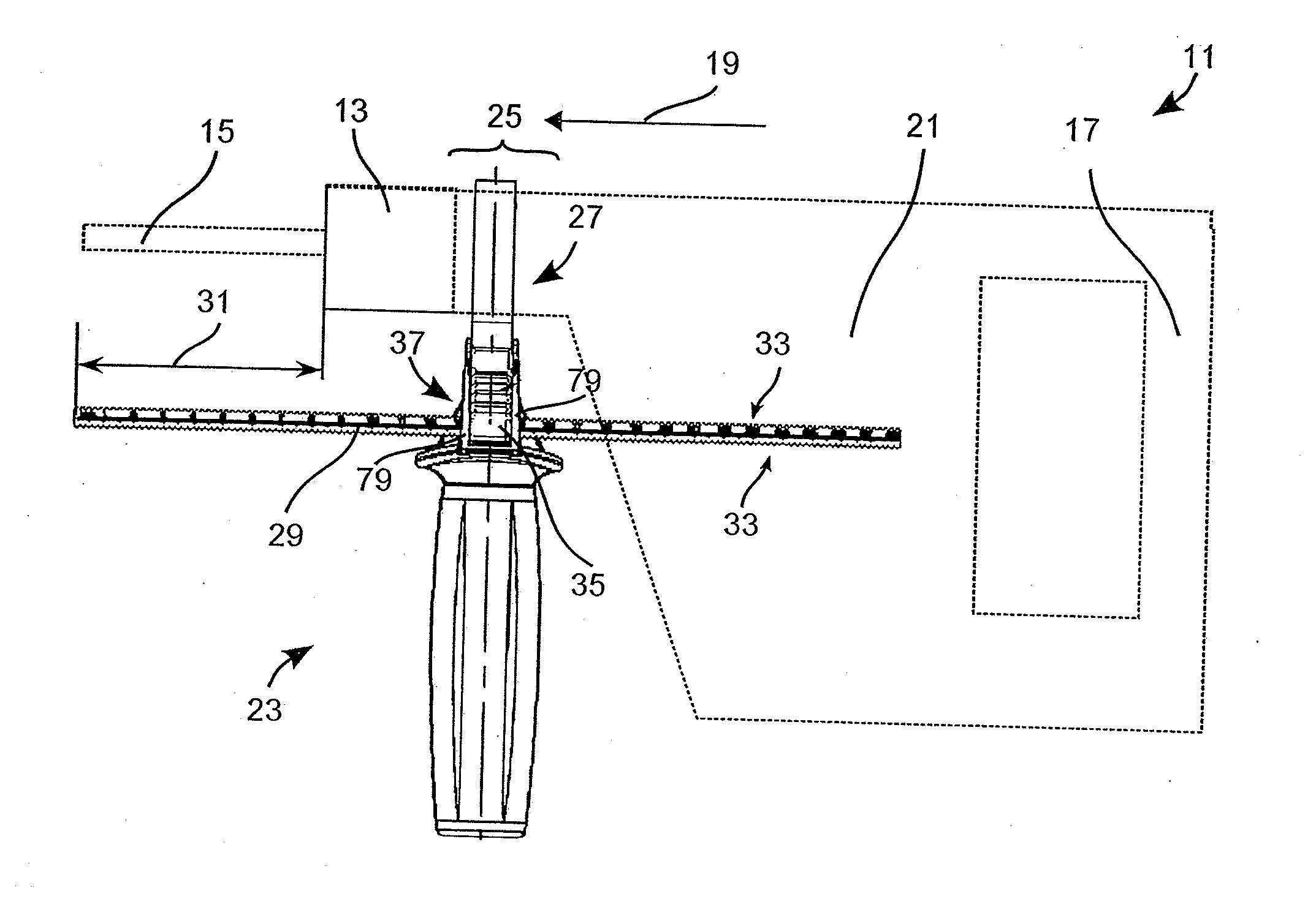 Auxiliary handle