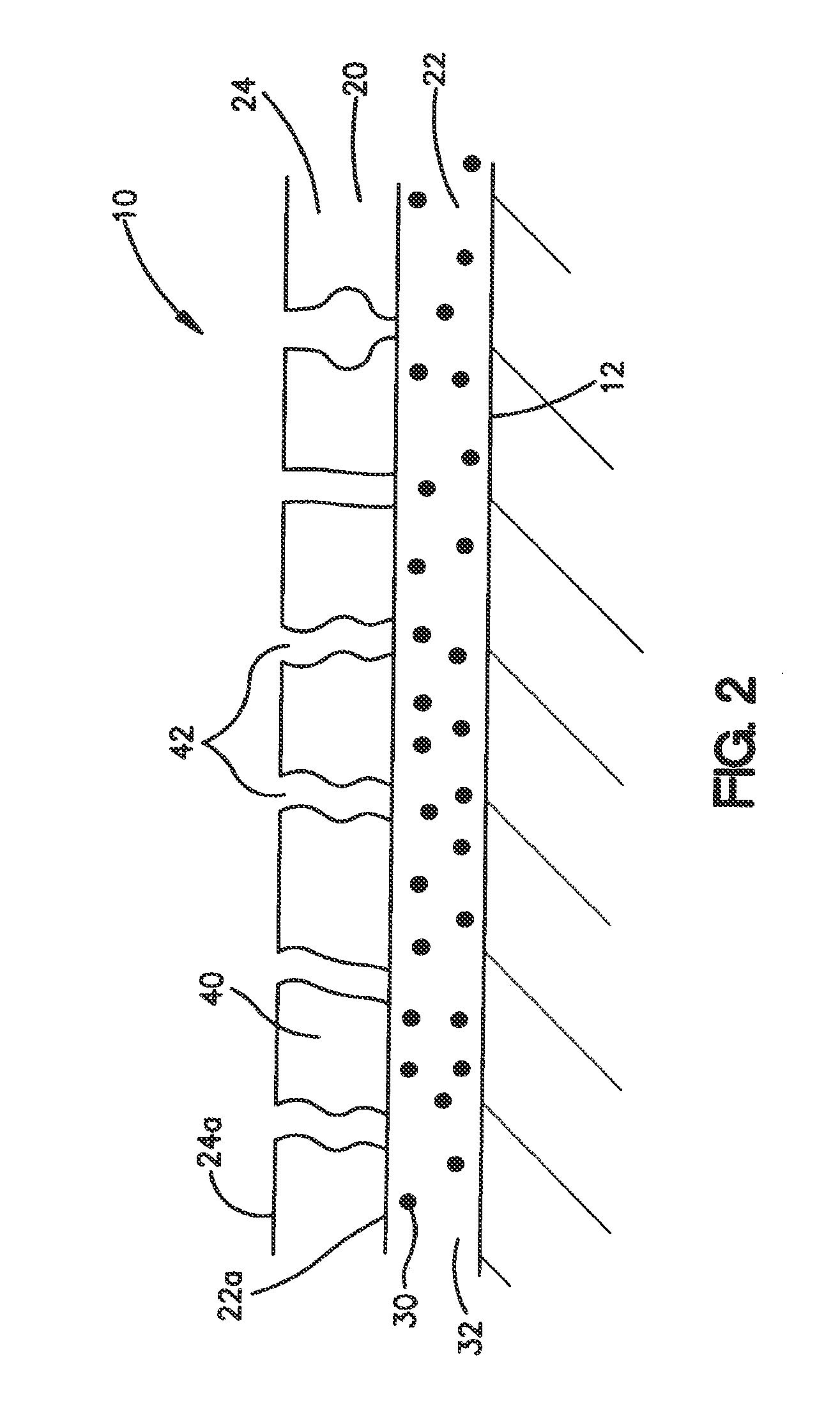 Coatings for Medical Devices Comprising a Therapeutic Agent and a  Metallic Material