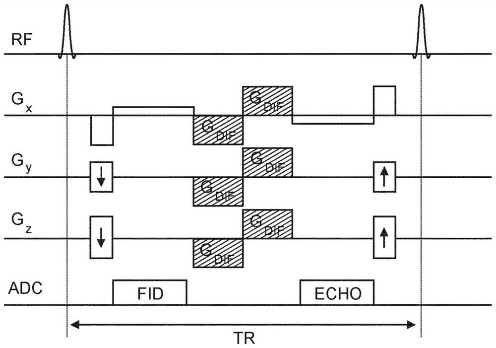 Dual echo steady state mr imaging using bipolar diffusion gradients