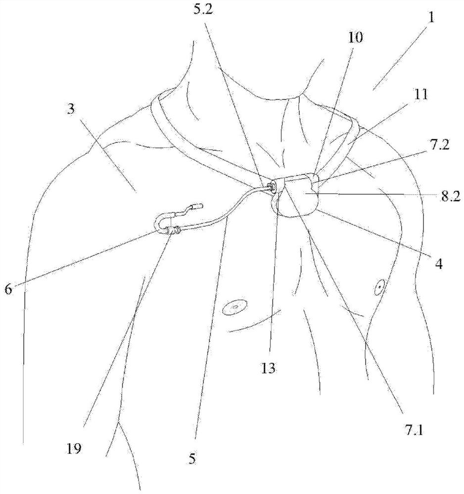 Fastening system for electrical stimulation generator