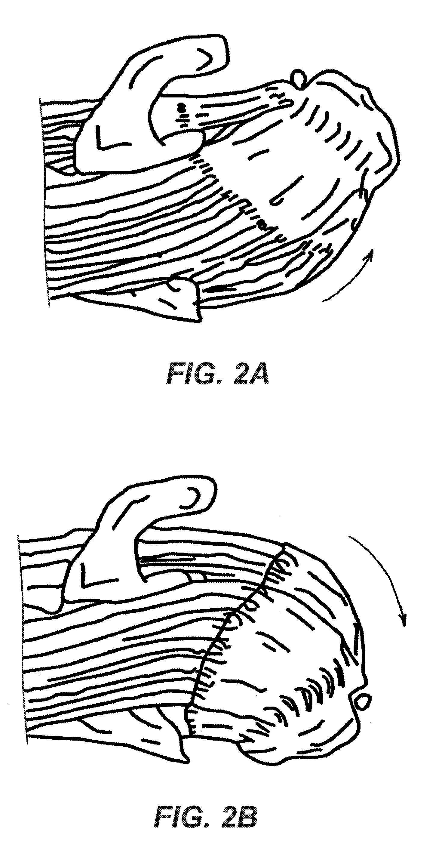 Segmentally rigid suture and suturing technique