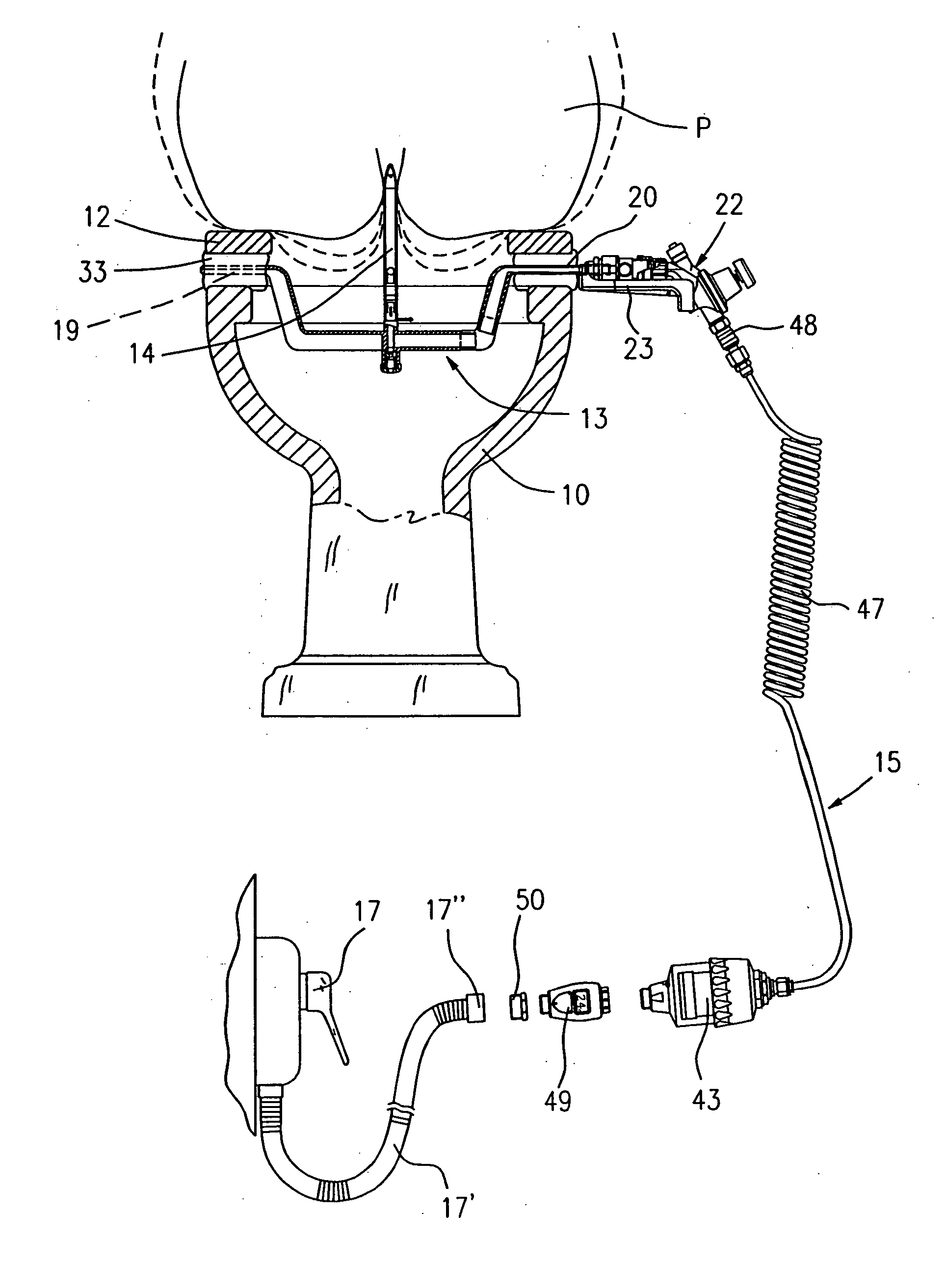 Medical apparatus for intestinal and vaginal treatments