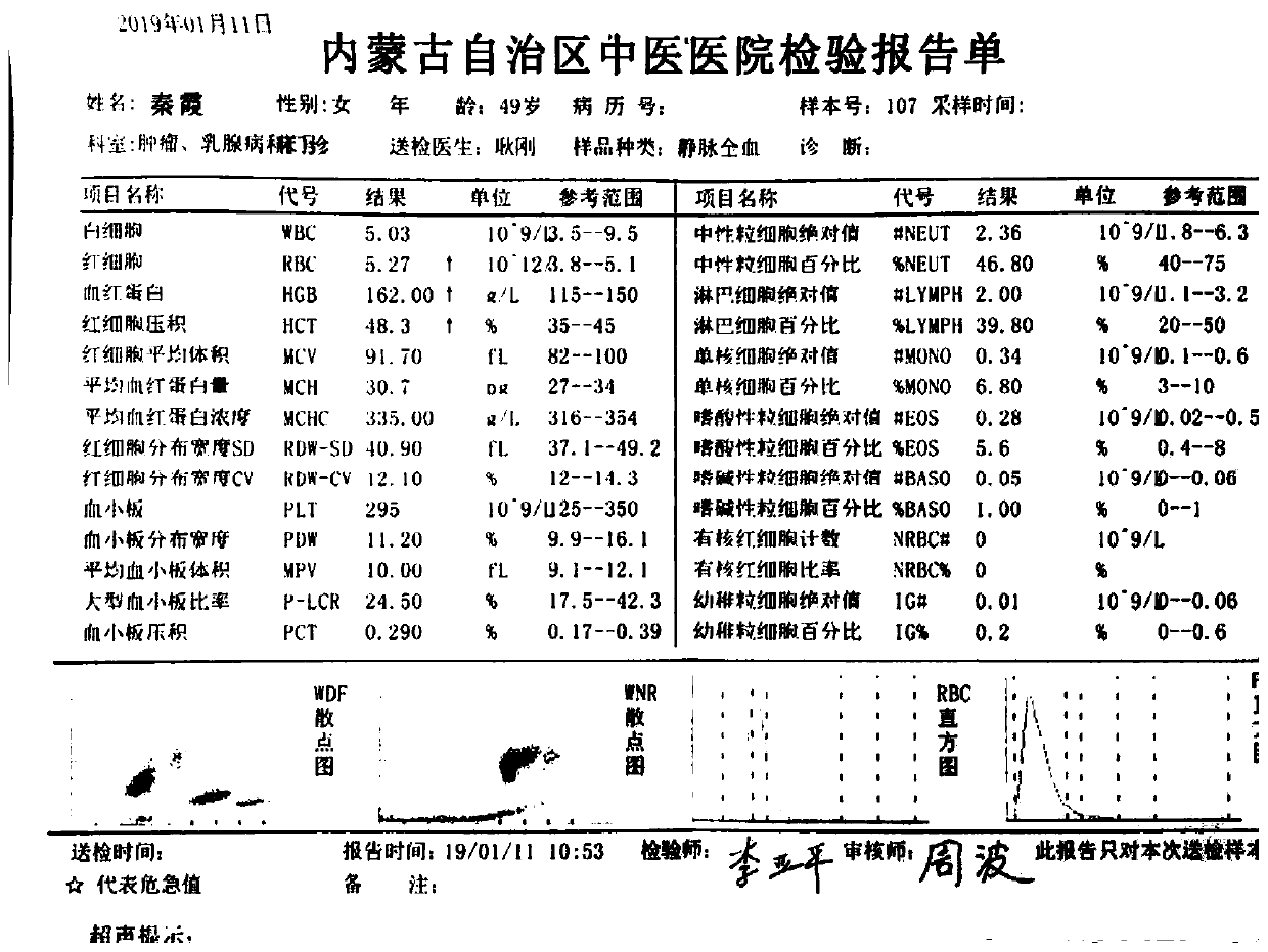 Traditional Chinese medicine composition for treating female mammary gland hyperplasia and preparation method thereof