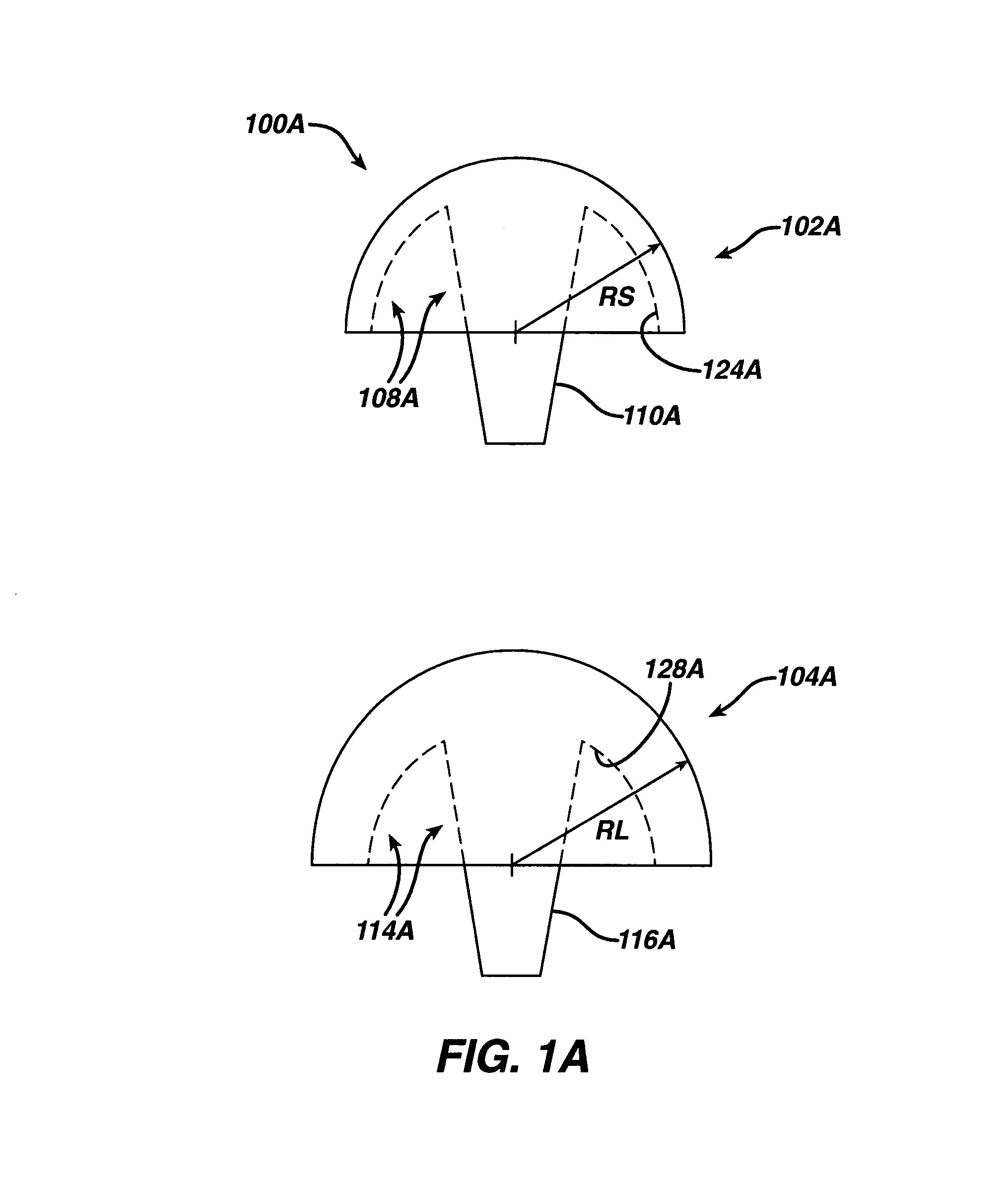 Prosthetic implant, trial and associated method
