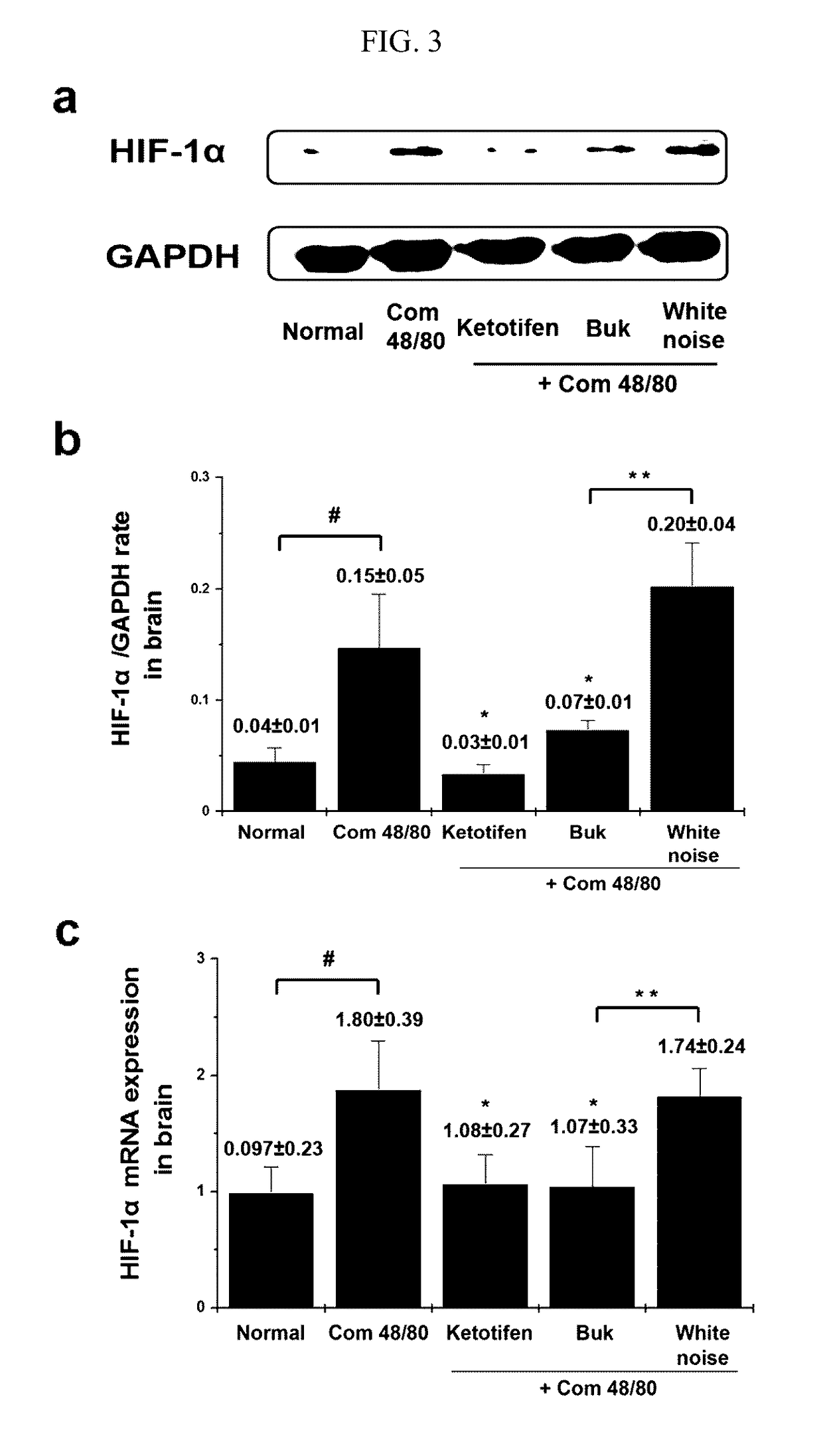 Method for alleviating or treating anaphylaxis