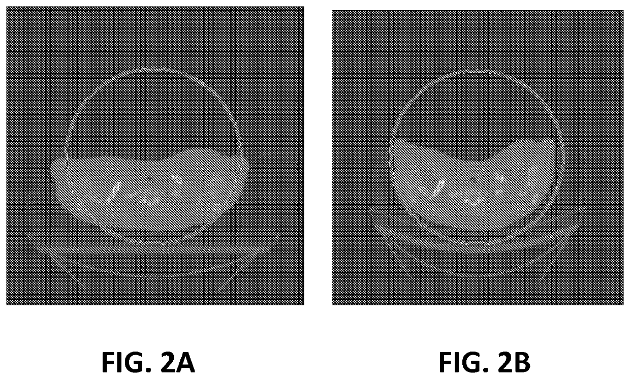 Image deformation methods and curved  couch for radiotherapy treatment  planning