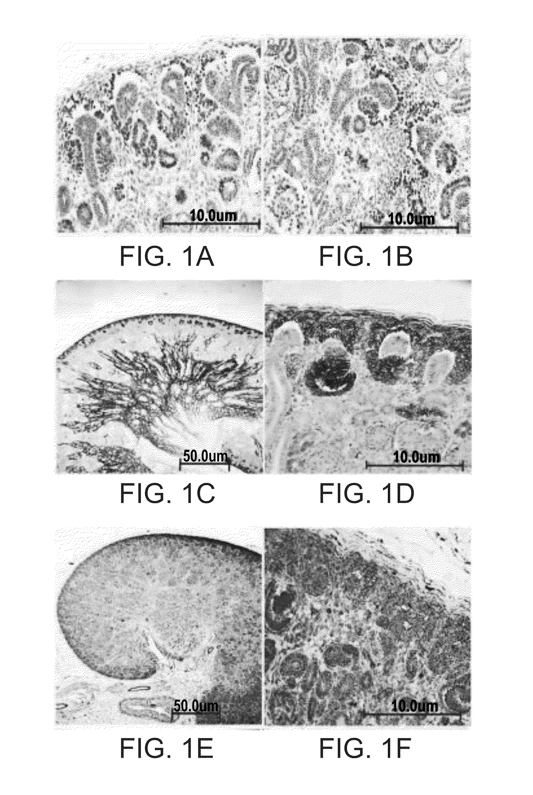 Isolated populations of renal stem cells and methods of isolating and using same