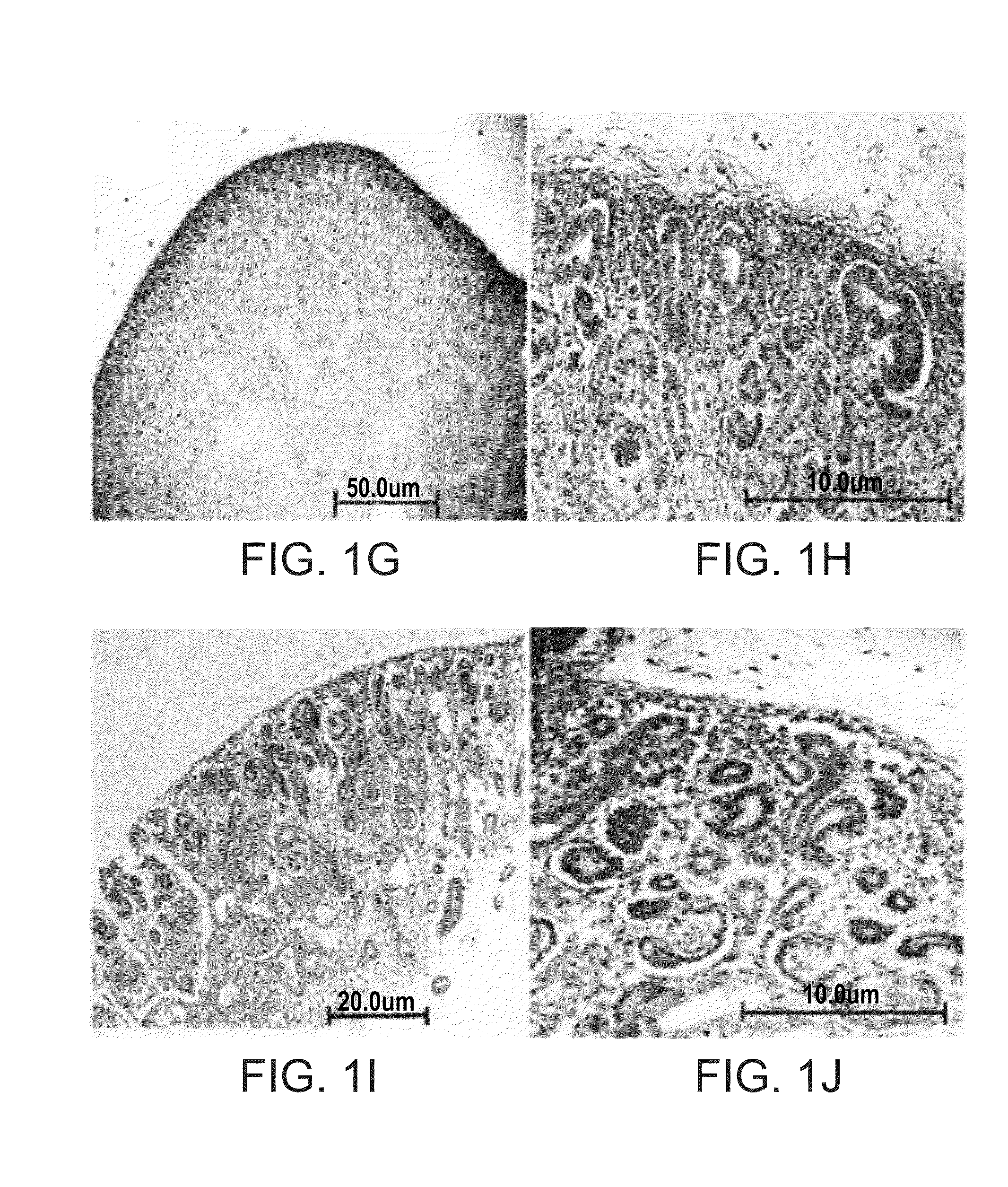 Isolated populations of renal stem cells and methods of isolating and using same