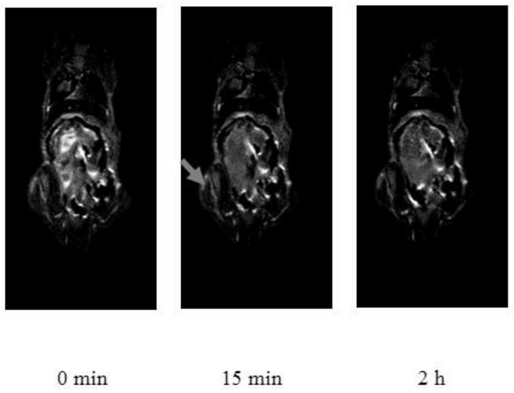 Polysaccharide magnetic resonance and fluorescence dual-mode imaging diagnostic agent and preparation method thereof and diagnostic reagent