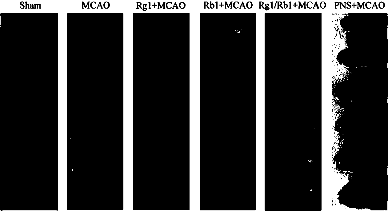 Total panax notoginsenosides, preparing method thereof, preparations thereof and applications thereof