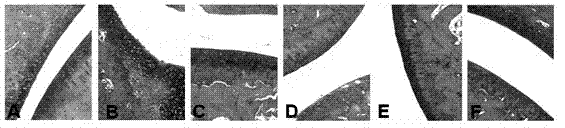 Application of icariin in preparation of medicaments for treating gout