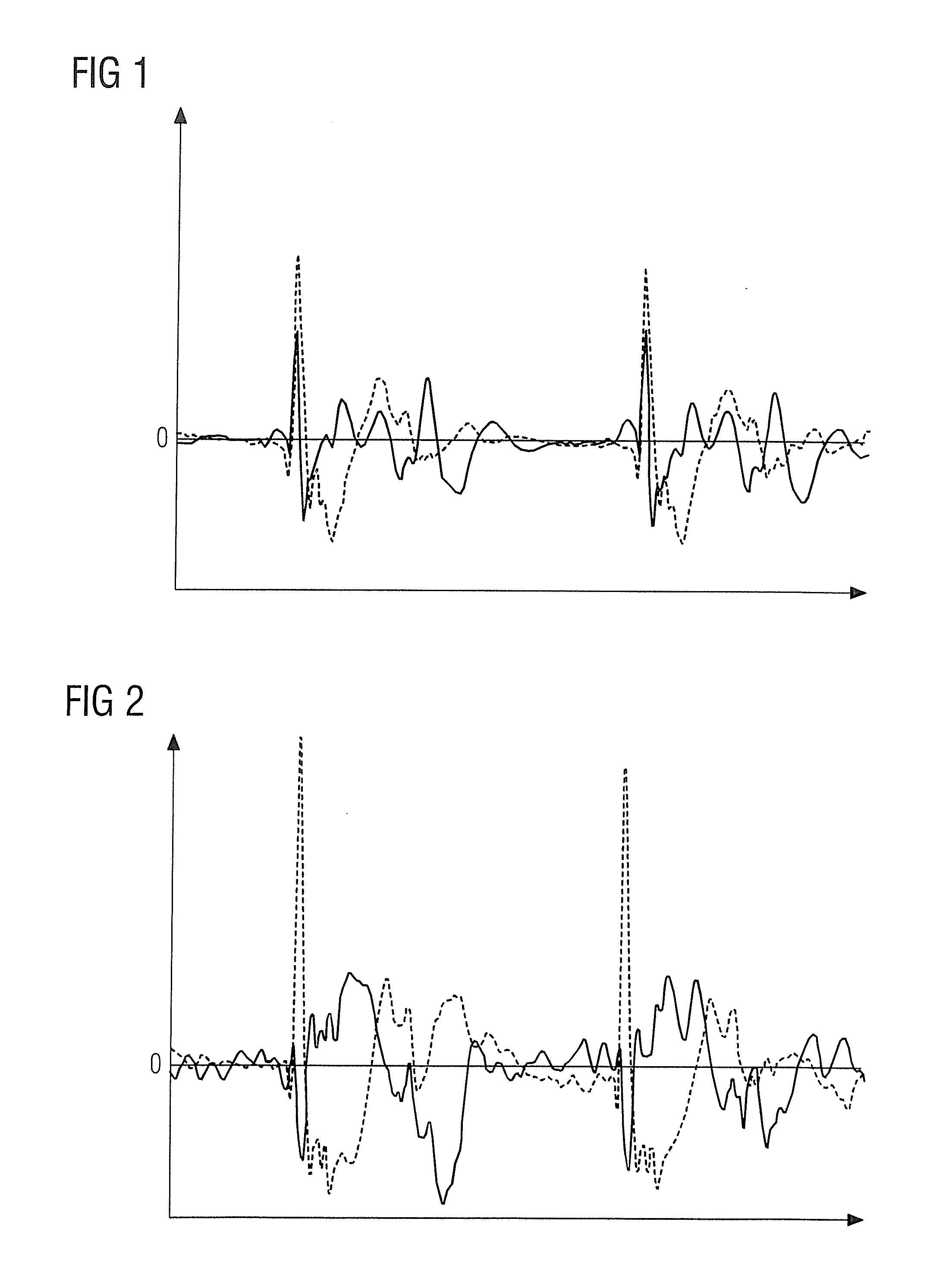 Method, ECG measuring device, and medical imaging device for determining an r-wave in an ECG signal