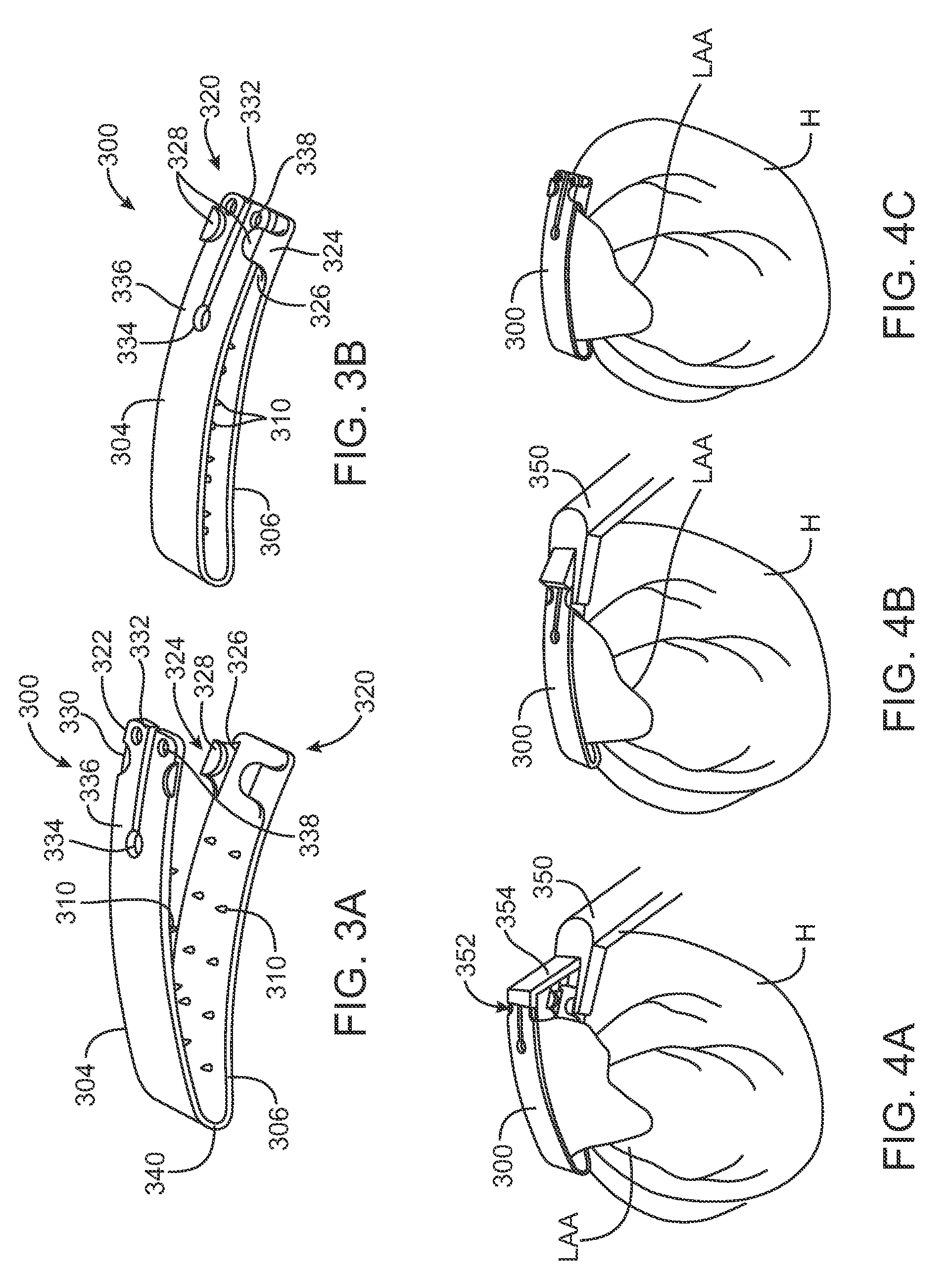 Left atrial appendage devices and methods