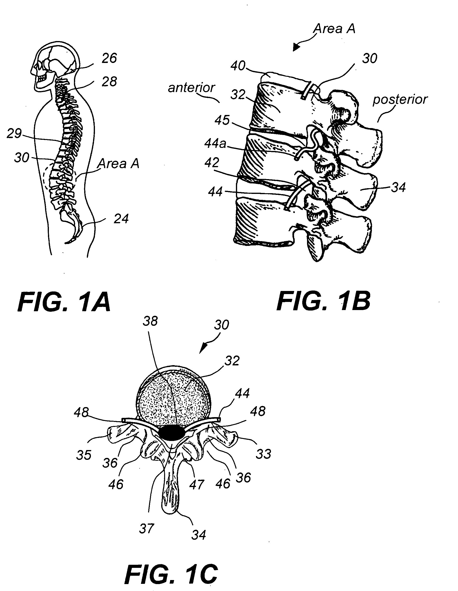 Method and device for kinematic retaining cervical plating