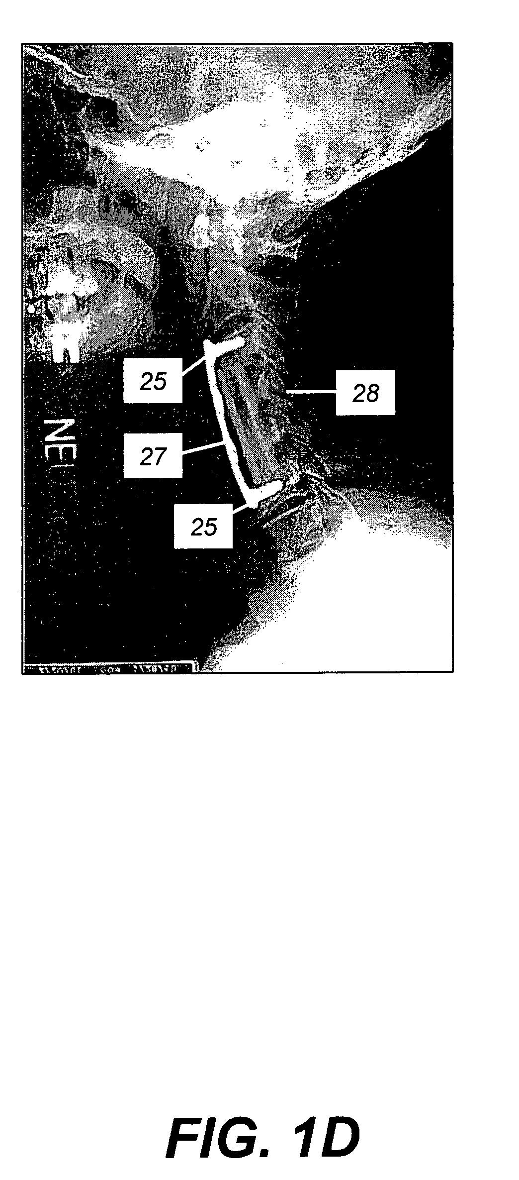Method and device for kinematic retaining cervical plating
