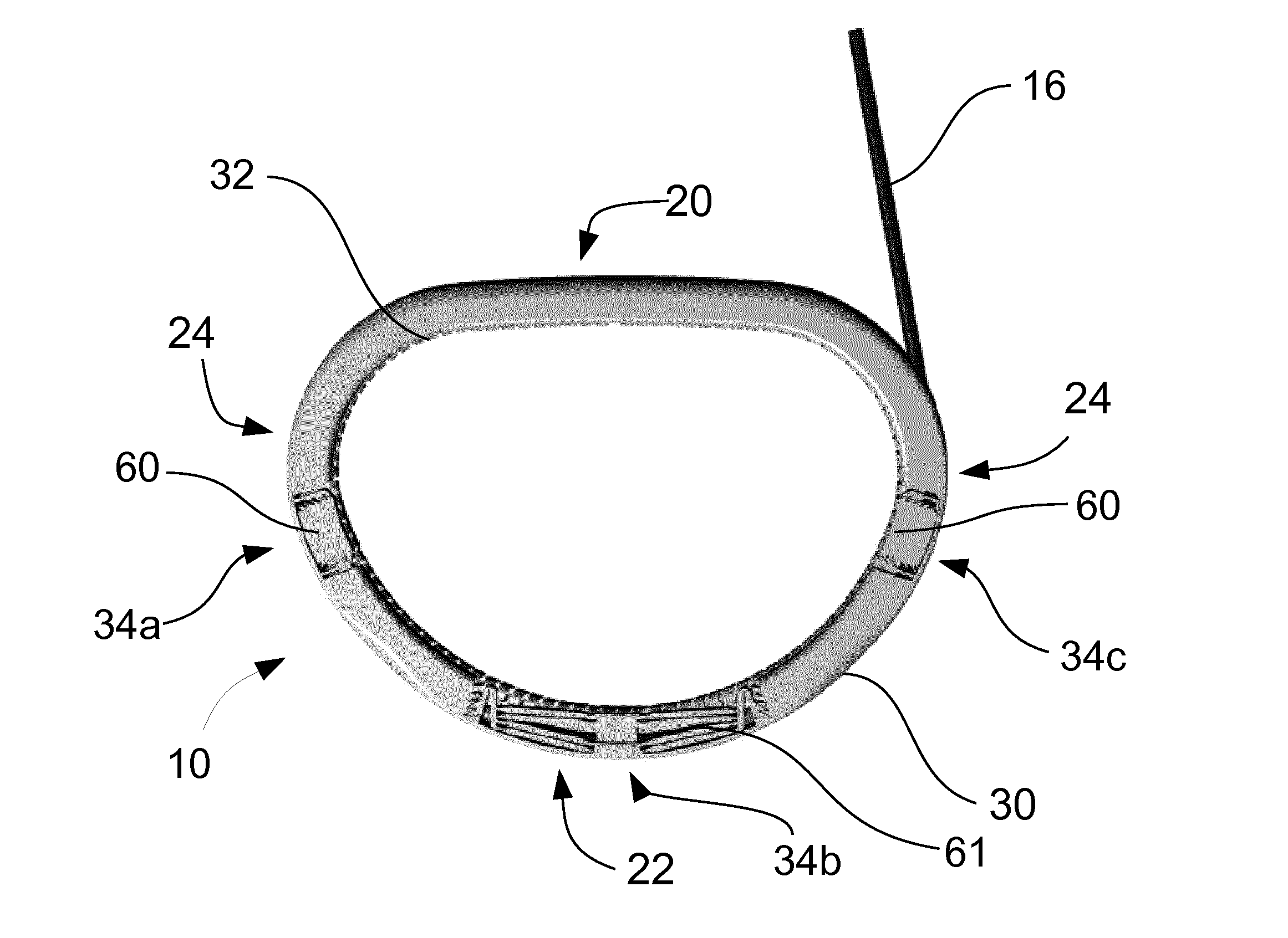 Adjustable annuloplasty ring and system