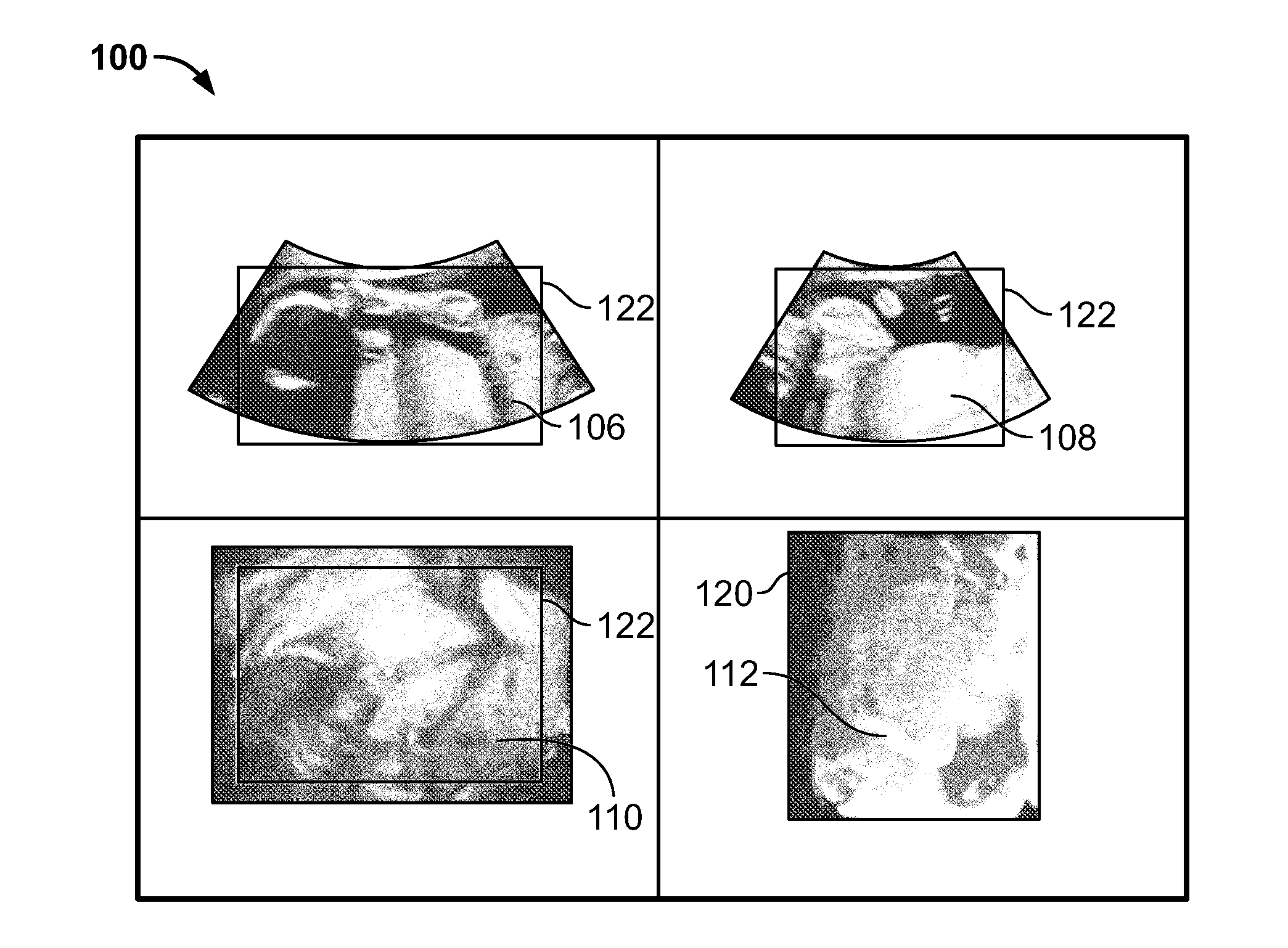 Methods and systems for removing occlusions in 3D ultrasound images