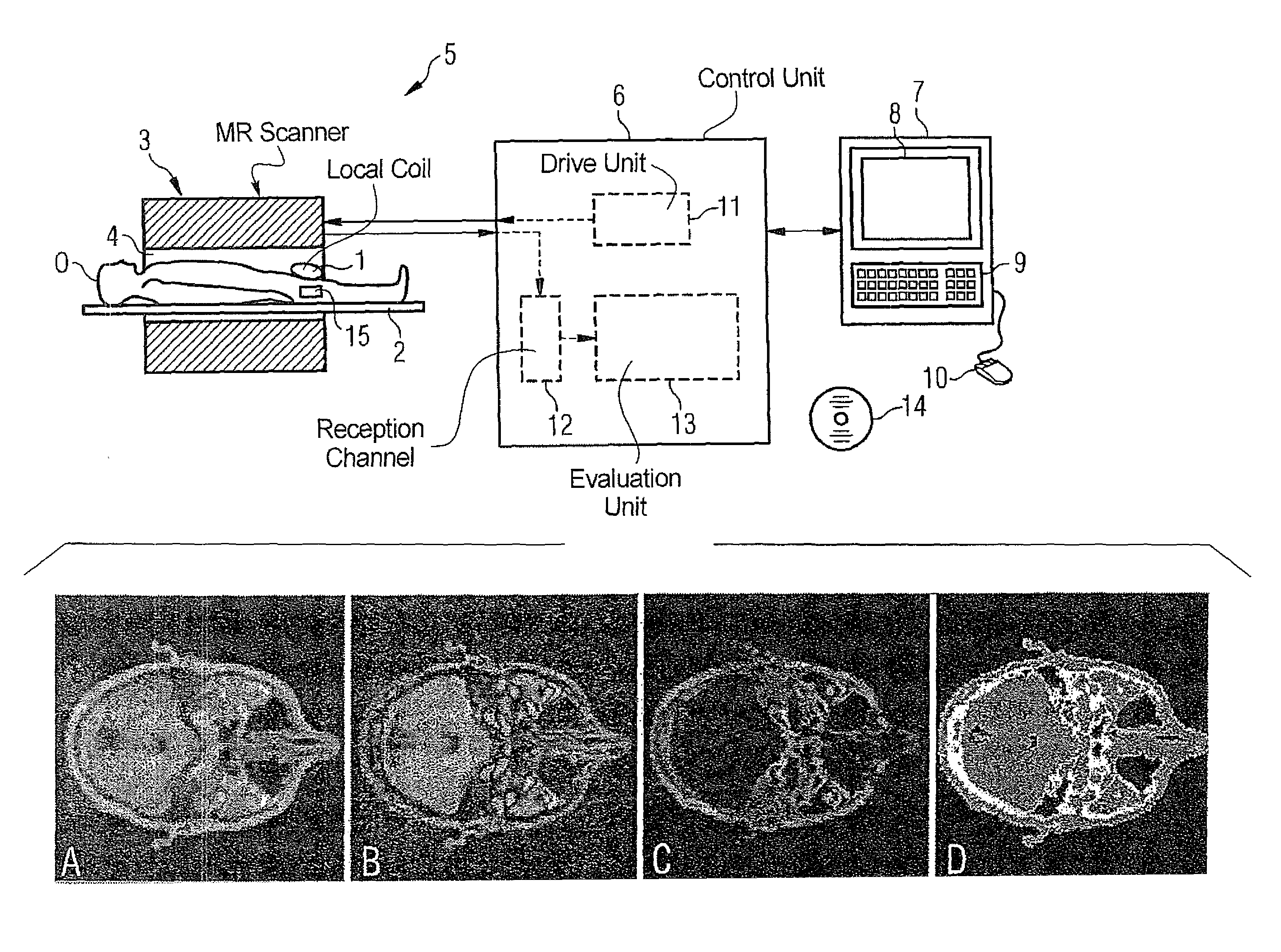 Magnetic resonance method and apparatus for automatically determining objects that attenuate penetrating radiation