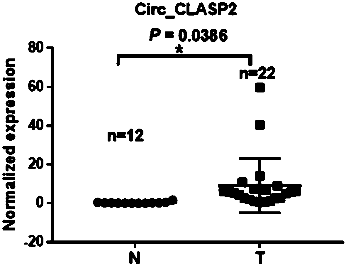 Application of reagent for detecting circ_CLASP2 to preparation of nasopharynx cancer diagnosis preparation as well as kit
